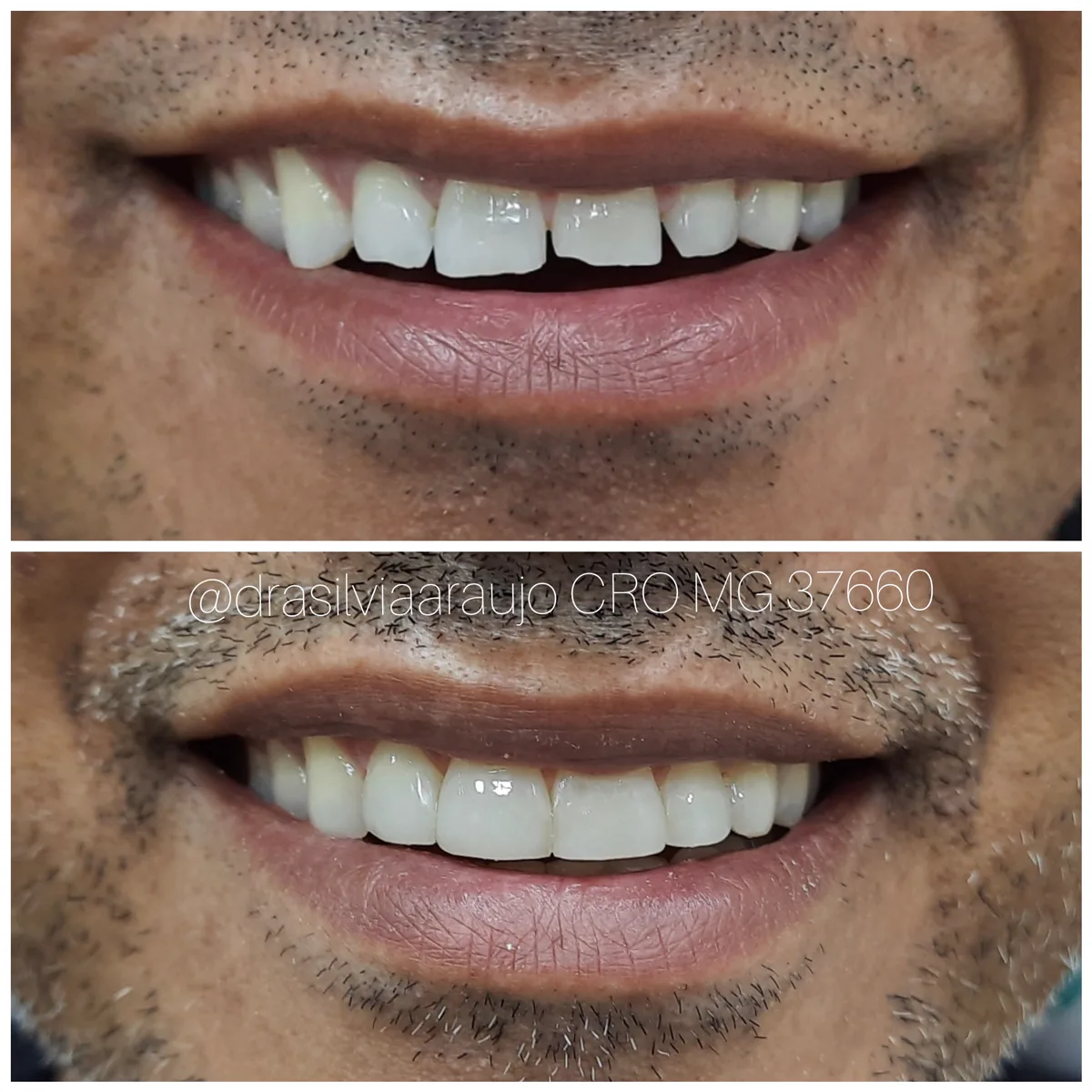 Caso clínico 2 — antes e depois