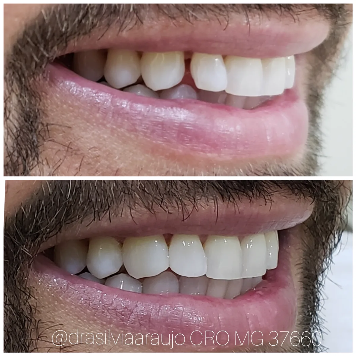 Caso clínico 6 — antes e depois